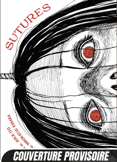 Sutures